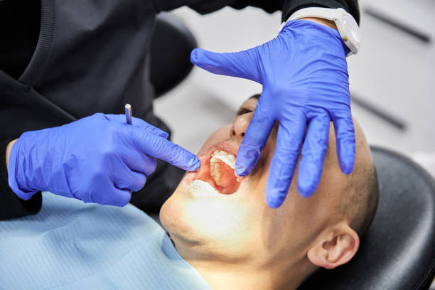 Best Broken or Chipped Tooth Repair in Royalton, MN